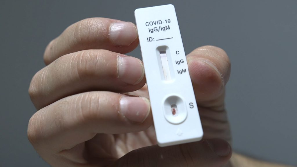 Come si esegue il test sierologico per il Covid-19