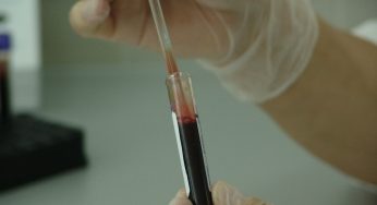 Giuseppe De Donno si è suicidato: aveva avviato la cura con il plasma