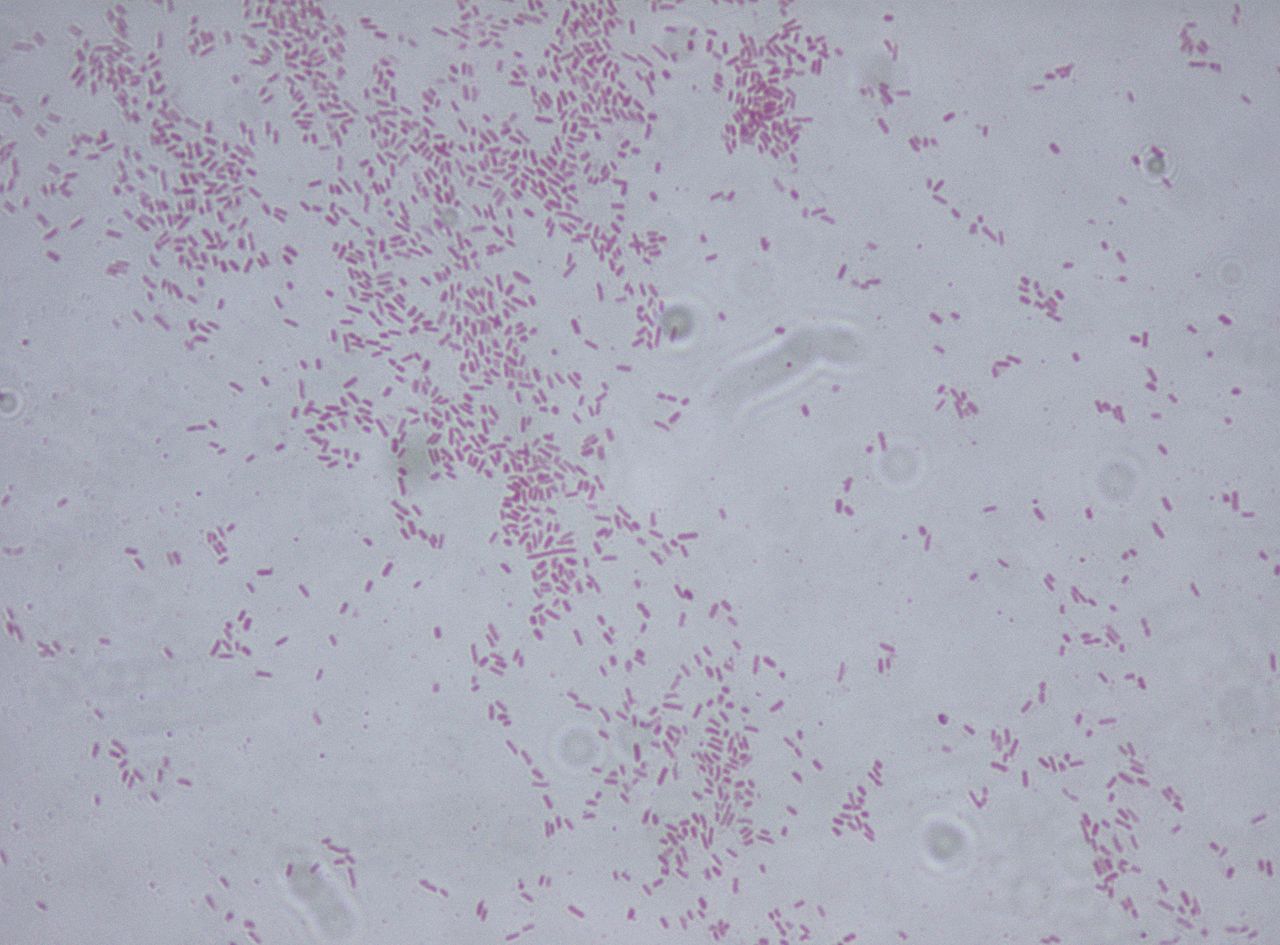 Citrobacter, batterio killer, Verona