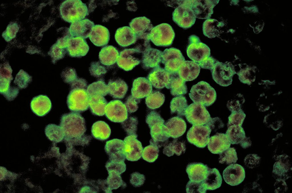 Naegleria fowleri, ameba mangia-cervello