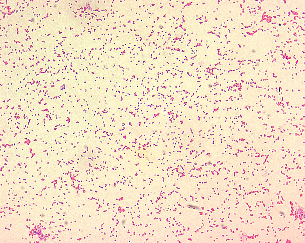 Il batterio che causa la brucellosi visto al microscopio