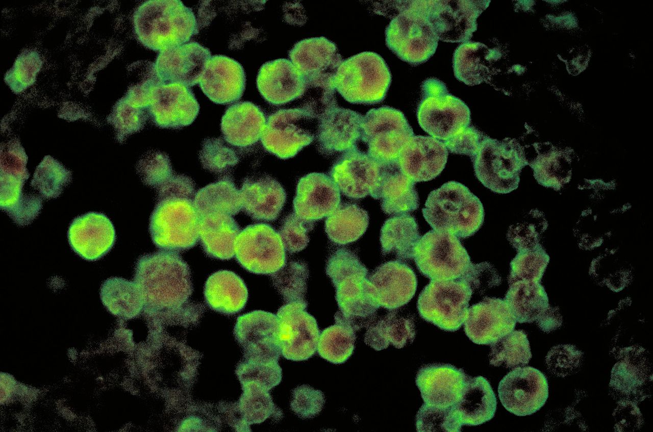 Naegleria Fowleri, “l’ameba mangia cervello”