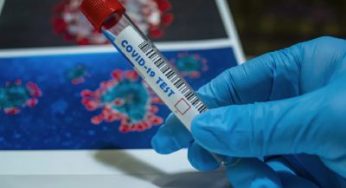Covid, documento Oms: ombre su gestione pandemia in Cina