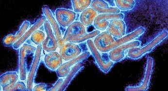 Virus di Marburg, Oms lancia allarme: “Molto infettivo, prima vittima”
