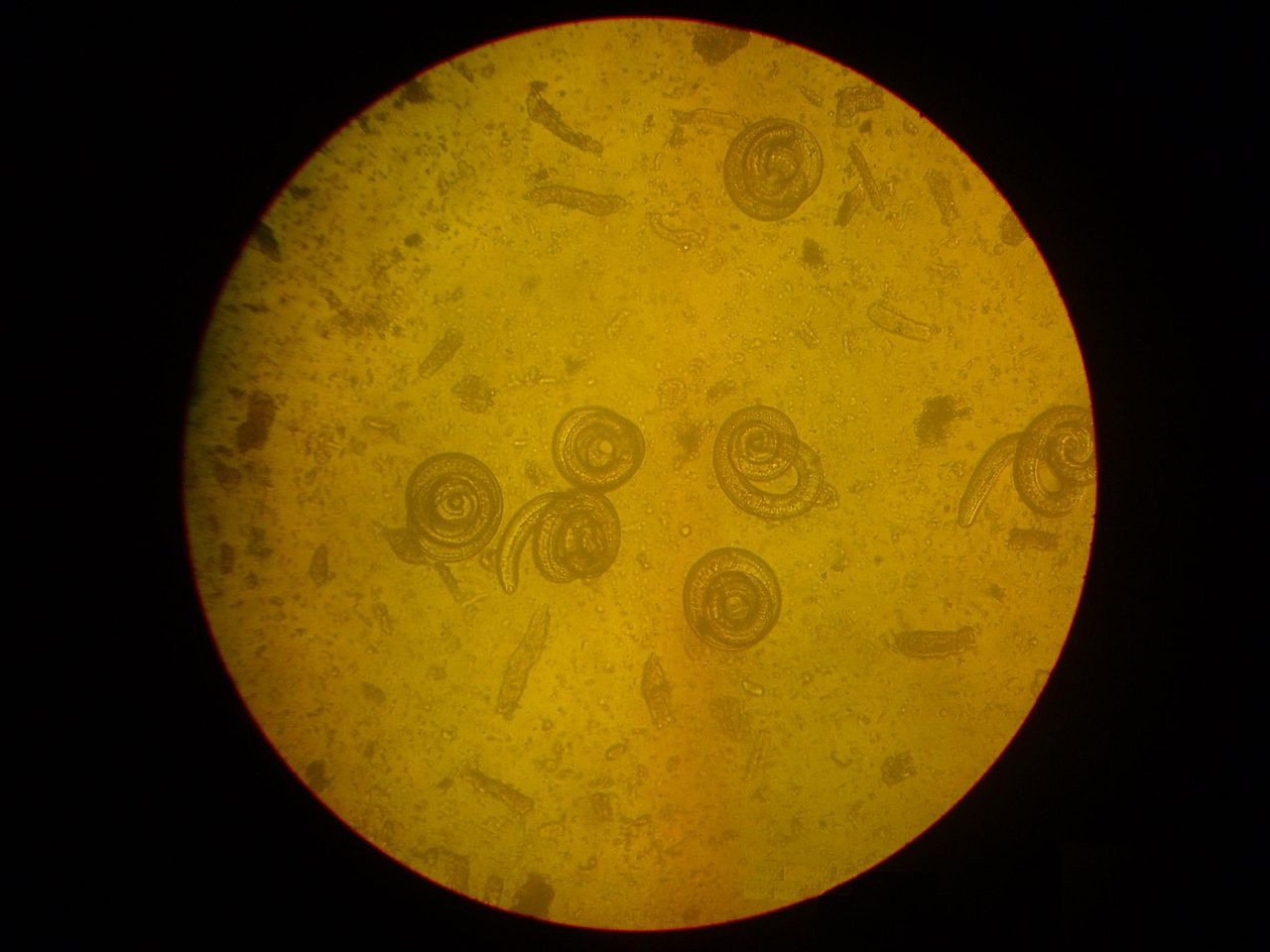 Trichinella spiralis vista al microscopio (Izvora)