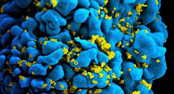 Hiv, iniziano i test di Moderna e Iavi sul vaccino a mRna