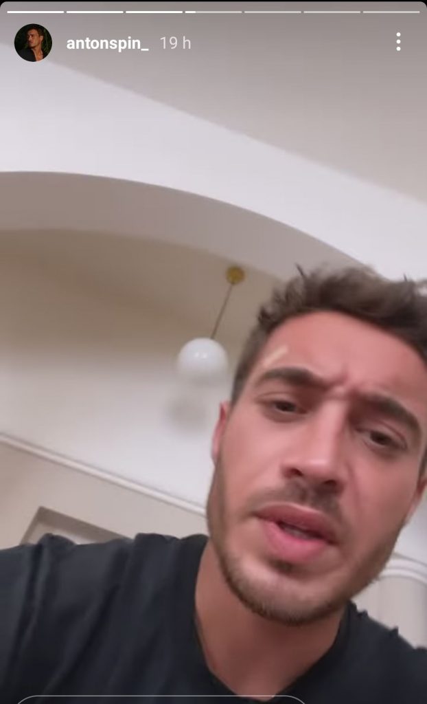 Antonino Spinalbanese con un cerotto in fronte