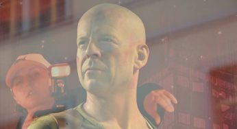 Afasia: cos’è la malattia di Bruce Willis | Quali sintomi dà, quali sono le cure