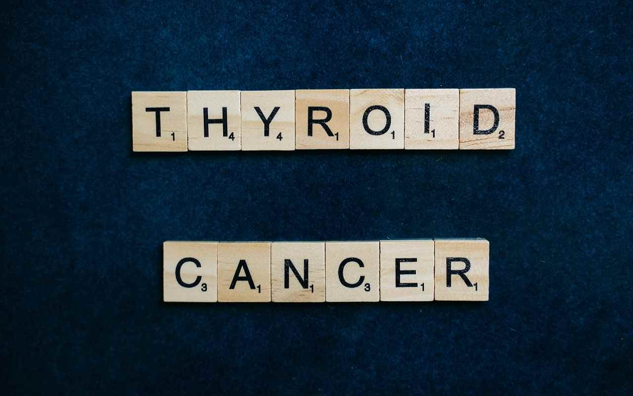 Il tumore alla tiroide