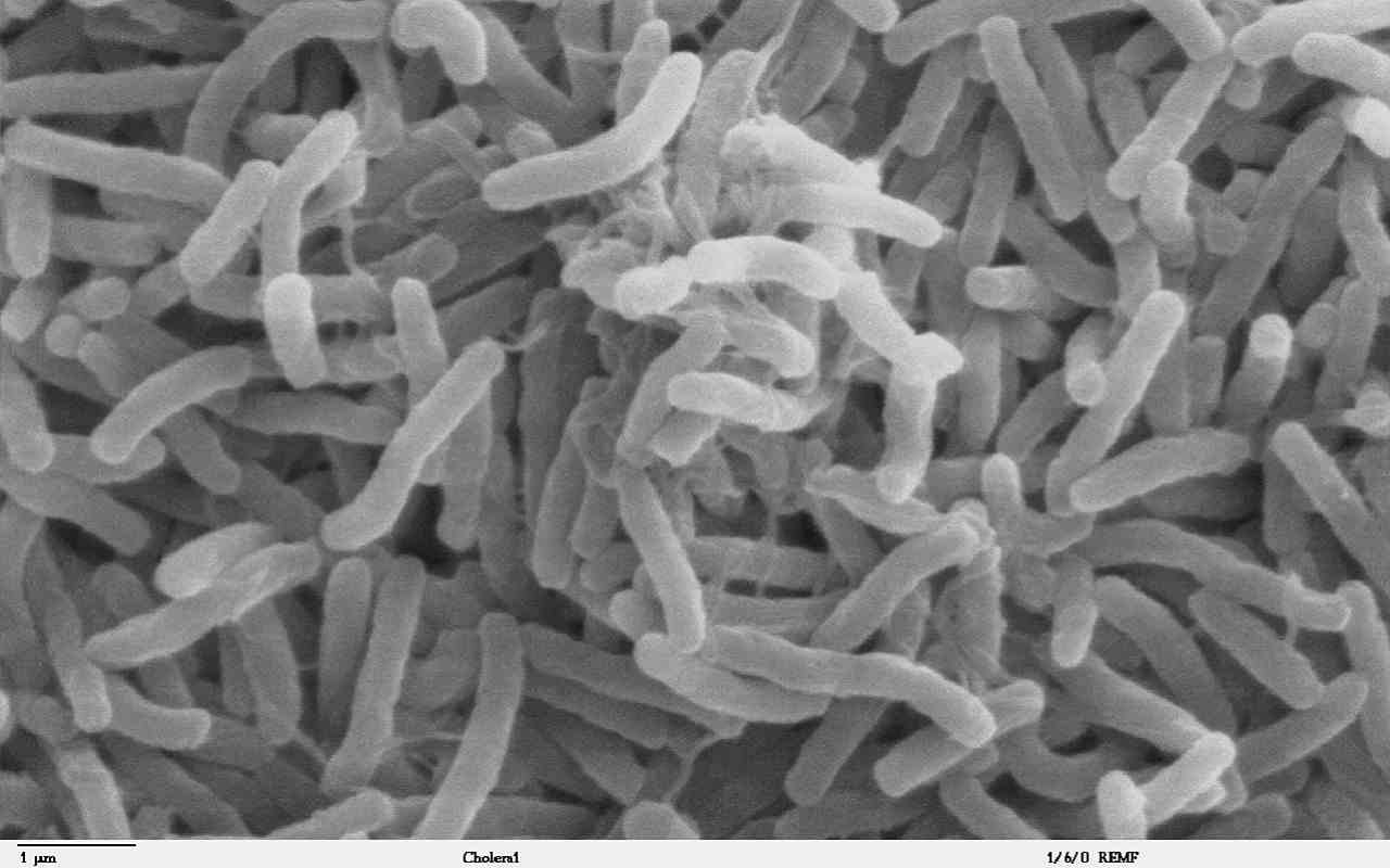 I batteri che causano il colera