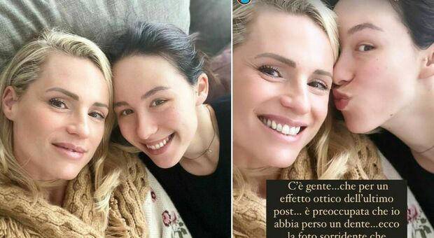 michelle hunziker dente mancante