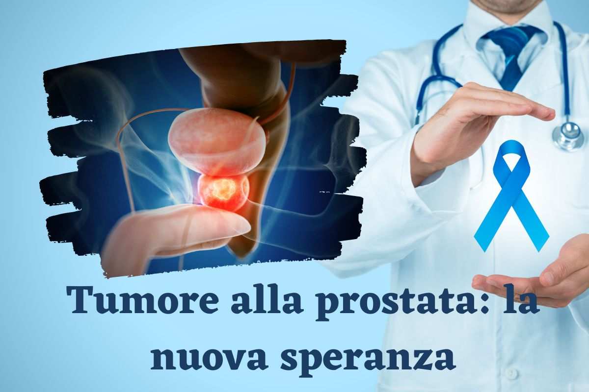 Nuova speranza per il tumore alla prostata