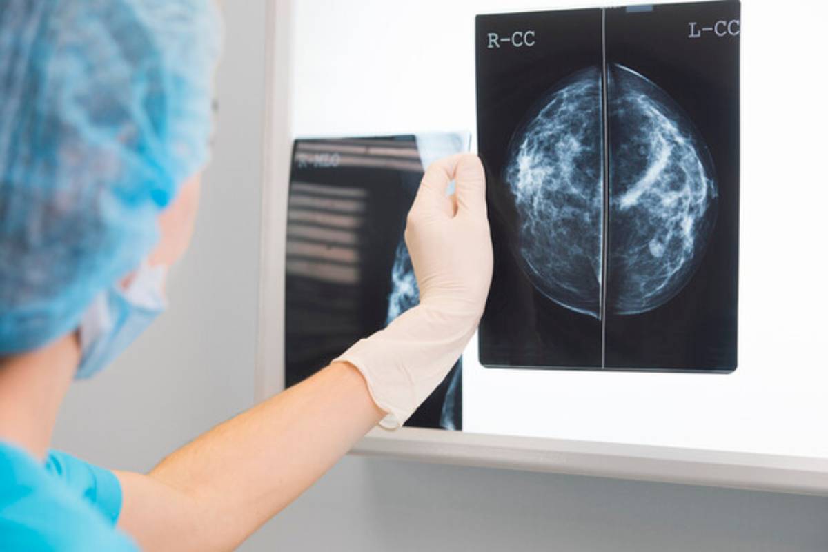 Tumori, i migliori ospedali