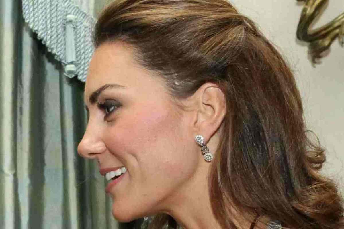 kate middleton cicatrice sulla tempia