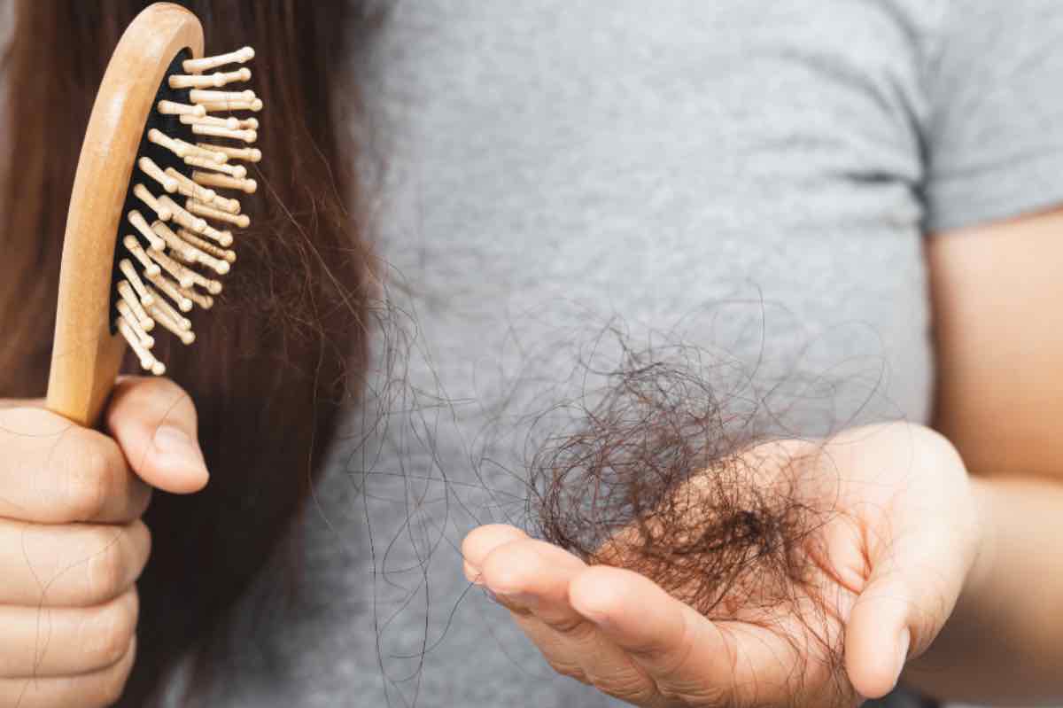 rimedi perdita capelli donna