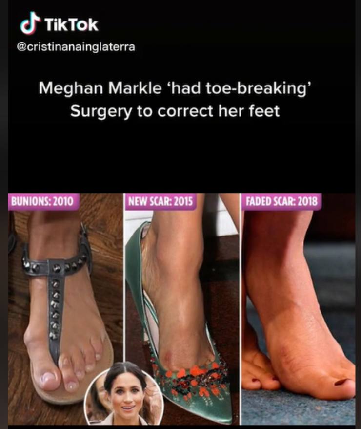 Screen di TikTok dei piedi di Meghan Markle a confronto