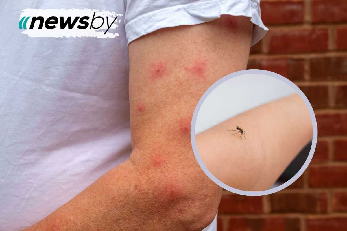 Perché le zanzare pungono solo alcuni