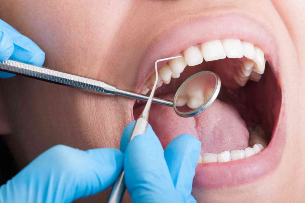 In Croazia per la cura dei denti, ecco perché molti italiani lo fanno